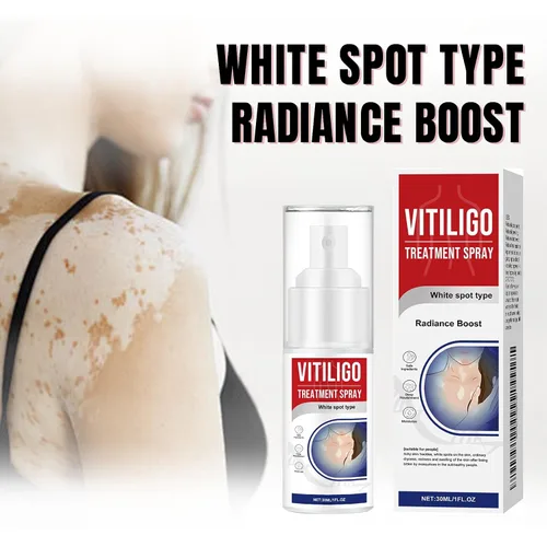 Vista 2 de Spray de tratamiento de vitíligo, tratamiento de vitíligo natural para la piel, mejora la pigmentación de la piel, crema de vitíligo adecuada