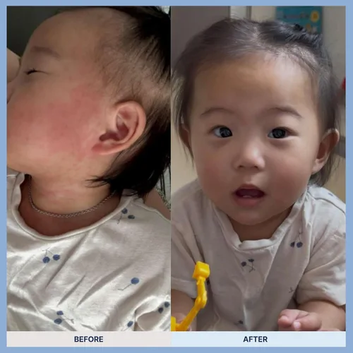 Vista 8 de Mongdies Baby Ato Lotion-Soluciones hidratantes e hidratantes para pieles sensibles y delicadas, excelente grado en alemán Derma Test, todos