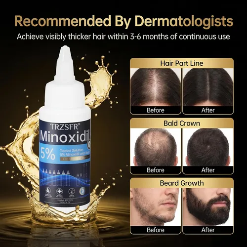 Vista 3 de Minoxidil - 5% para hombres y mujeres con aplicador de rodillo y bolígrafos aplicadores de precisión, solución tópica extra fuerte