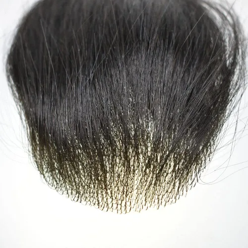 Vista 6 de Unidad de reemplazo de parche para cabello calvo en V de piel fina para línea capilar – 100% Remy humano transparente piel tupé sistemas frontales