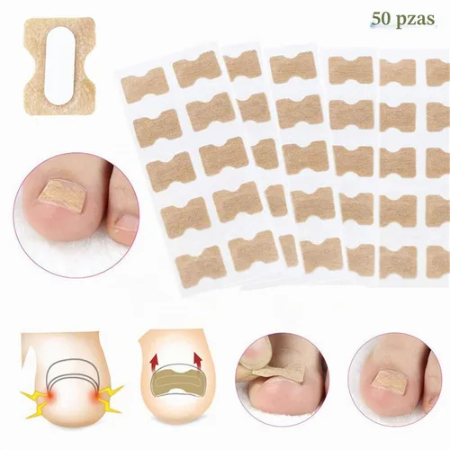 Vista 2 de Parche de corrección de uñas encarnadas, 50 calcomanías de uñas encarnadas sin pegamento para uñas encarnadas curvadas para el cuidado de los pies