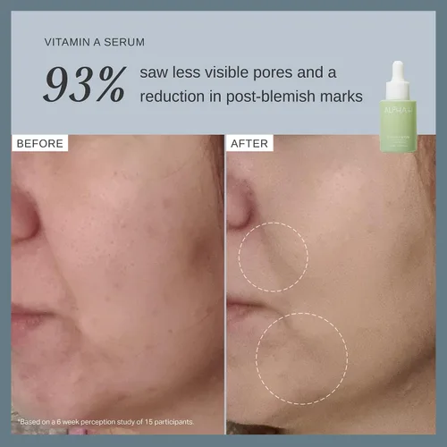 Vista 6 de Alpha-H Face Serum - Daily Brightening For Dull, Uneven Complexion - Helps Boost Glow And Smooth Texture - Lightweight Comfort For Dry, Sensitive