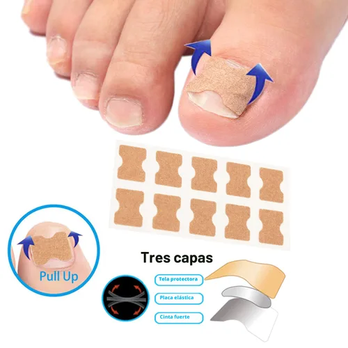 Vista 3 de Juego de corrector de uñas encarnadas con tiras de corrección,Kit de herramientas profesional de uñas encarnadas,Parche corrector de uñas
