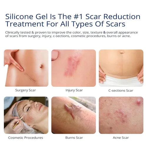 Vista 8 de Solución completa para el cuidado de cicatrices – Cinta de silicona para cicatrices + hojas de cicatrices + tratamiento de gel 100% de silicona
