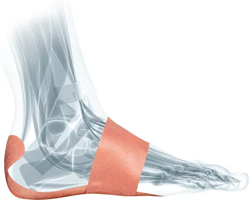 Vista 2 de MUELLER Sports Medicine PFTape, cinta atlética para aliviar el dolor de la fascitis plantar, soporte terapéutico para el pie, desechable, sin látex