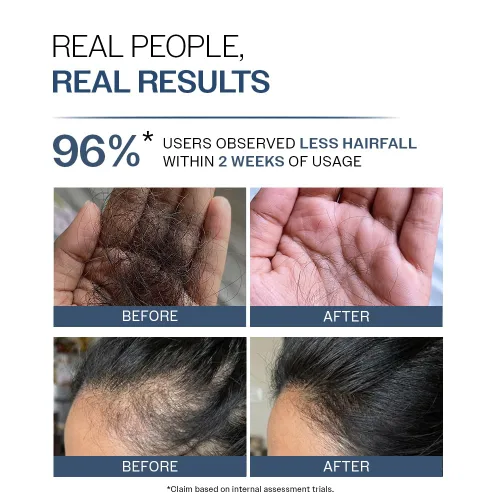 Vista 5 de Bare Anatomy Champú anticaídas Proporciona 5 veces control de caída del cabello pH 4.6 Adenosina y péptidos Fortalece las raíces débiles