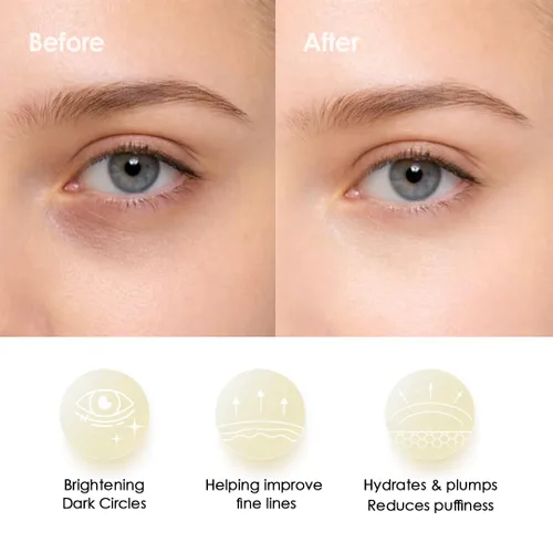 Vista 7 de Sweet Dreams - Máscaras de ojos doradas con colágeno brillante, parches coreanos para debajo de los ojos, ojos hinchados, ojeras y arrugas