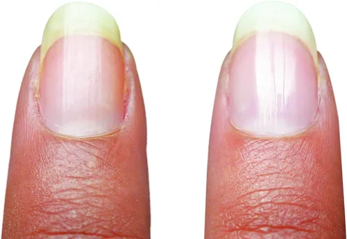 Vista 5 de Emjoi Manicura micro de uñas o manicura pedi: suaviza, pule y brilla al instante