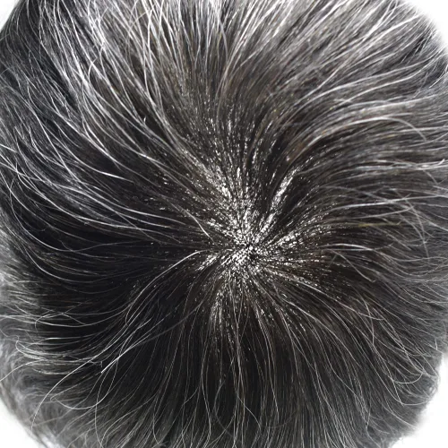 Vista 3 de Toupee - Sistema de reemplazo de cabello fino y duradero para hombre, piezas de cabello 100% humano para hombres, revestimiento de poliéster, unidad