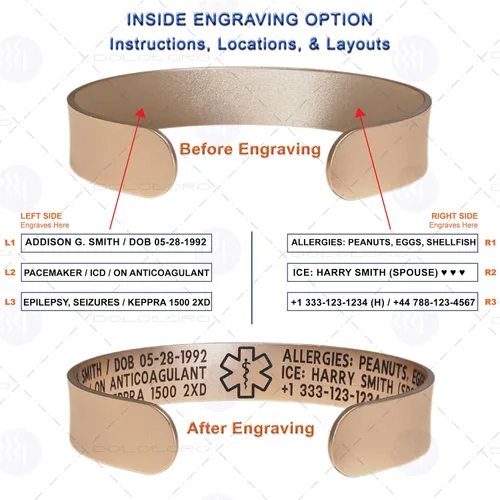 Vista 18 de Pulsera de identificación de alerta médica, acero inoxidable 316L, personaliza y personaliza, selecciona un tamaño de muñeca, de 6 a 9 pulgadas