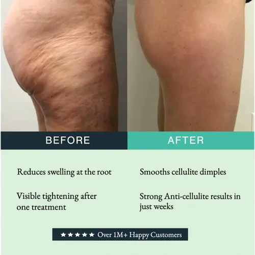Vista 5 de GUAM Fórmula anticelulítica para el frío, envoltura corporal de algas marinas para celulitis, arcilla tensora de la piel para celulitis corporal e