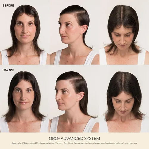 Vista 2 de VEGAMOUR GRO+ Suplementos avanzados para el crecimiento y la densidad del cabello