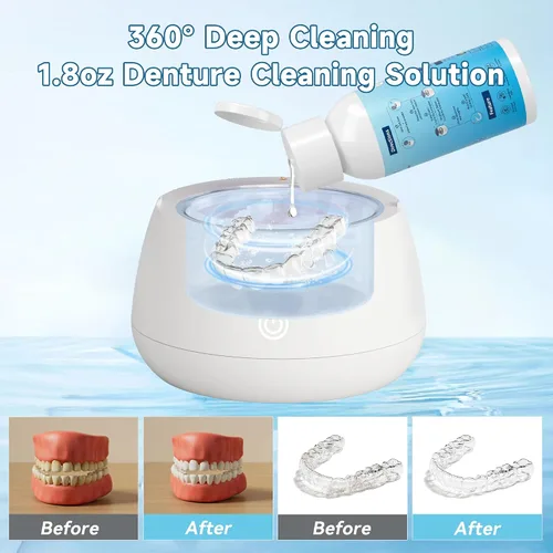 Vista 4 de Solución de limpiador ultrasónico para limpiador ultrasónico de dentaduras: limpieza profesional de retenedores, alineadores invisibles, protectores