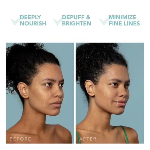 Vista 5 de FOREO UFO 3 mini 4 en 1 mascarilla facial dispositivo de cuidado de la piel - hidratante facial - antienvejecimiento - luz roja - calentamiento