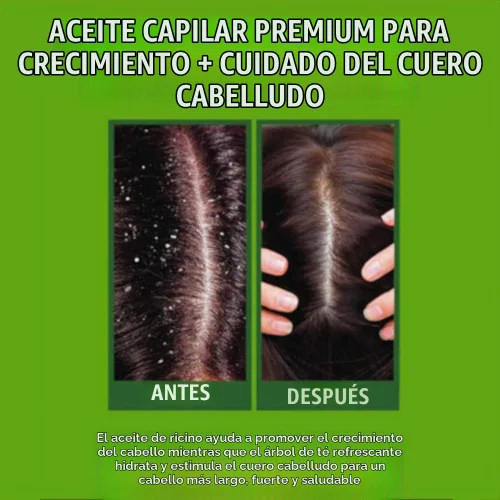 Vista 4 de Difeel Premium Castor Plus Tea Tree - Pro-Growth + Scalp Care Aceite para el cabello prémium de 2.5 onzas
