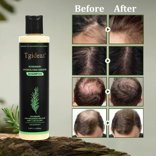 Vista 3 de Tgideas Champú orgánico para el crecimiento del cabello de romero para mujeres y hombres, champú natural espesante y fortalecedor con queratina