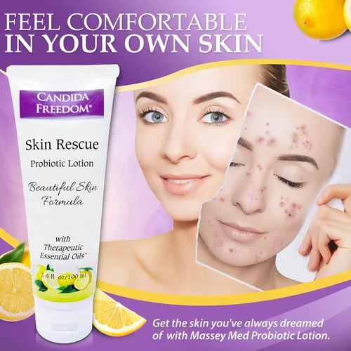 Vista 8 de Massey's Skin Rescue Probiotics Lotion - Loción diaria para hombres y mujeres - Aroma refrescante a limón - Humedad no grasa para una piel suave