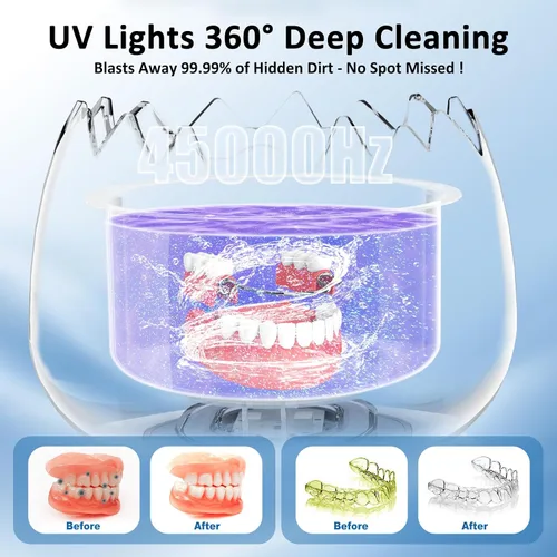 Vista 2 de Limpiador ultrasónico de retenedores para dentaduras, cápsula de limpieza dental con temporizador digital, 45 kHz/6.1 fl oz, limpiadores