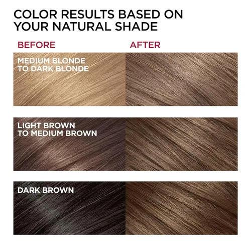 Vista 5 de LOreal Paris Superior Preference Sistema de cuidado