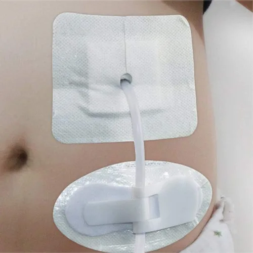 Vista 3 de Lifevv 5 soportes para catéter para piernas, dispositivo de fijación de tubo de superficie con catéter antideslizante, correa de pierna