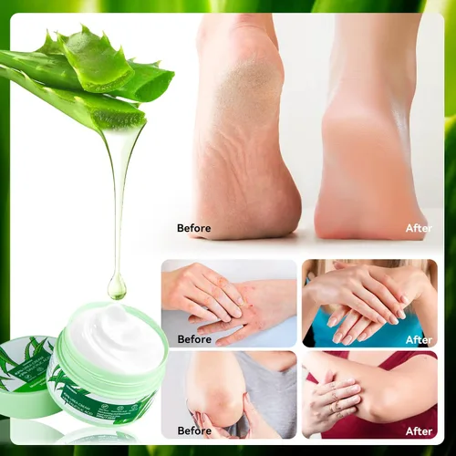 Vista 5 de Crema de urea 42 por ciento para pies, 7.0 onzas, 2% ácido salicílico, aloe vera, ácido hialurónico, crema hidratante profundamente para pies secos