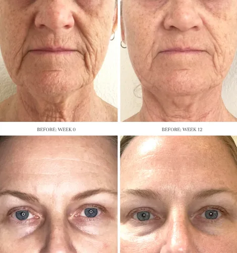 Vista 2 de City Beauty Concentrado exfoliante Dermal Reset - Exfoliante facial diario de ácido láctico AHA - Solución para arrugas, textura, decoloración