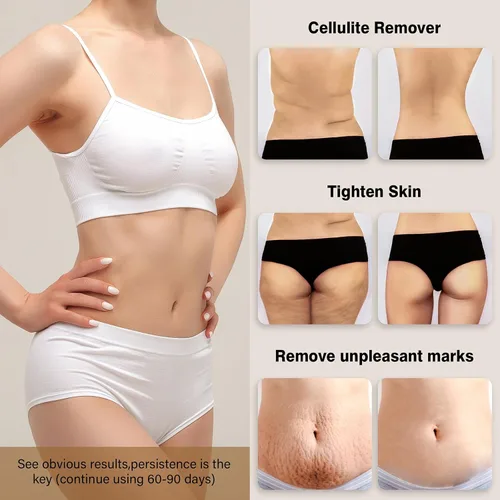 Vista 5 de Máquina para esculpir el cuerpo, masajeador de celulitis corporal inalámbrico para vientre, cintura, pierna, trasero, brazo, regalos para mujeres