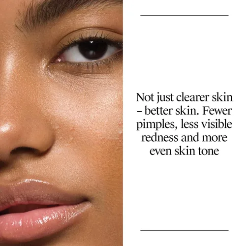 Vista 4 de Neutrogena Lavado de acné sin aceite, limpiador facial para combatir el acné con medicina de ácido salicílico, tratamiento para el acné