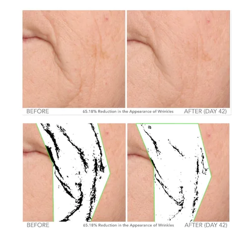 Vista 3 de Serious Skincare - Beyond - Suero intensivo de vitamina C para la cara - Tratamiento facial de 60 días para una piel sana y brillante e iluminadora