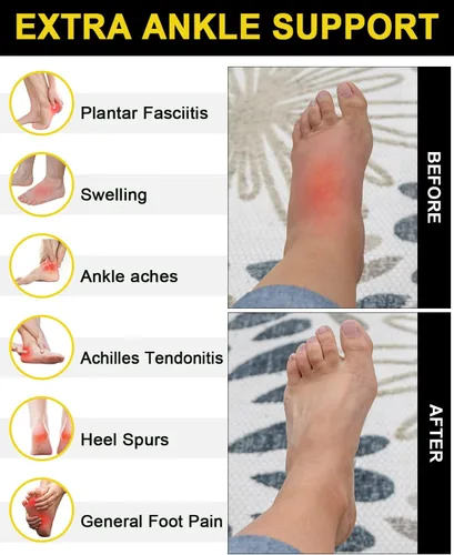 Vista 2 de 5 pares de calcetines de compresión de cobre para mujeres y hombres, calcetines de tobillo para fascitis plantar con soporte de arco para atletismo