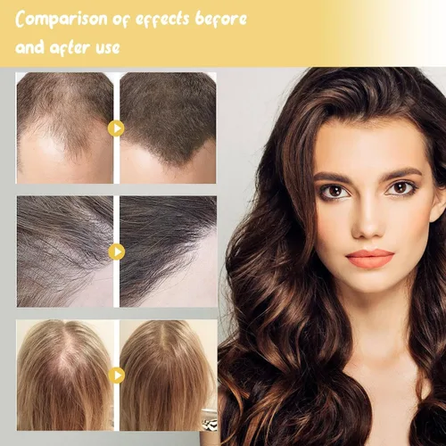 Vista 3 de Champú de aceite de Batana,Aceite de batana para el crecimiento del cabello,Champú DeBatana Para La Caida Del Cabello,Champús contra la pérdida