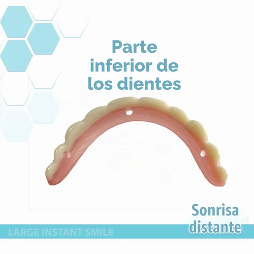 Vista 4 de Instant Smile - Chapa hecha a mano de gran tamaño - Original - ¡Arregla tu sonrisa en solo minutos!