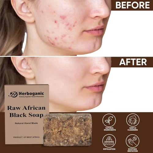Vista 4 de HERBOGANIC Barra de jabón negro africano crudo Paquete de 1,16 oz 100% natural puro Producto de Ghana. El jabón negro es ideal para acné, eczema