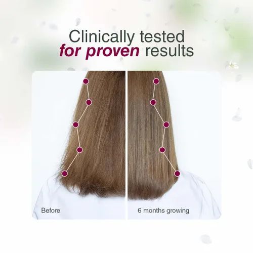 Vista 2 de Bellahair Revive, fortalece y brilla con nuestro lujoso aceite natural para el cabello, alimentado por aceite de amaranto para el crecimiento