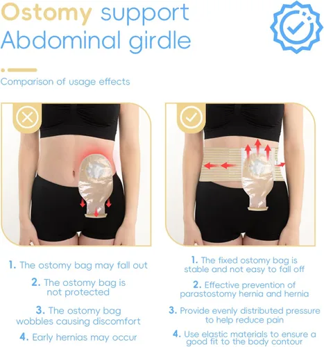 Vista 3 de Cinturón de ostomía abdominal, banda elástica transpirable para el vientre, antihernia para cuidados postoperatorios, después de una cirugía