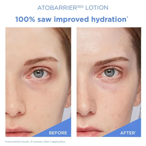 Vista 4 de AESTURA ATOBARRIER365 Hidratante facial coreano ligero con ceramidas Fortalece la barrera, hidratación de absorción rápida, adecuado para pieles