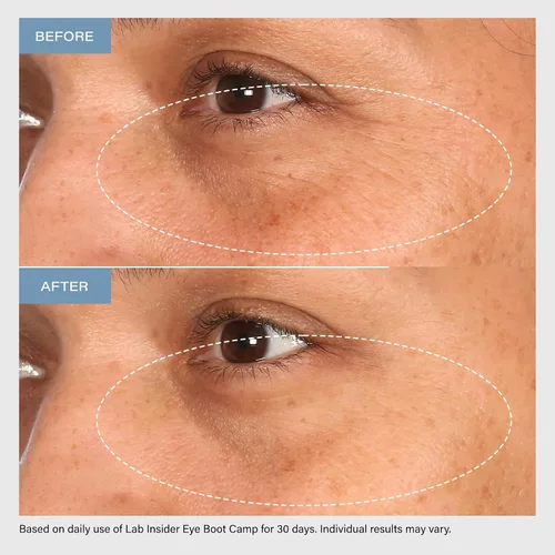 Vista 8 de SKINN Lab Insider - Set de regalo para el cuidado de la piel para 30 días, crema de ojos con cafeína de día y noche, suero para debajo de los ojos