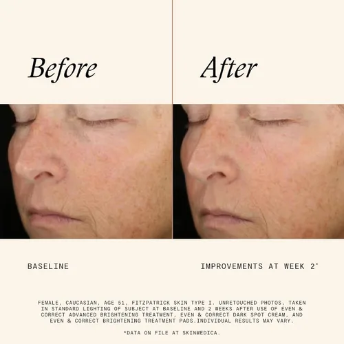 Vista 5 de SkinMedica Even & Correct - Almohadillas de tratamiento iluminadoras para exfoliación facial, almohadillas de ácido glicólico al 10% que
