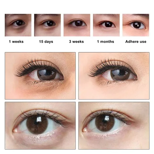 Vista 5 de Máscara de ojos de oro de 24 quilates, 25 pares de máscaras para ojos hinchados y ojeras, parches debajo de los ojos para hidratación profunda