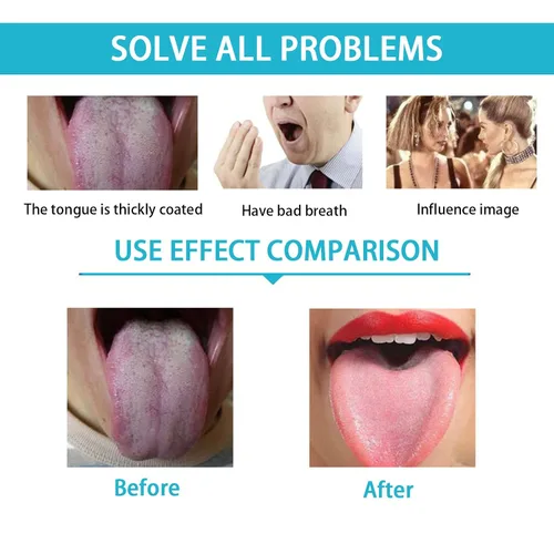 Vista 2 de Paquete de 2 raspadores de lengua, limpiadores de lengua de acero inoxidable, raspador de lengua para adultos, reduce el mal aliento y el aliento