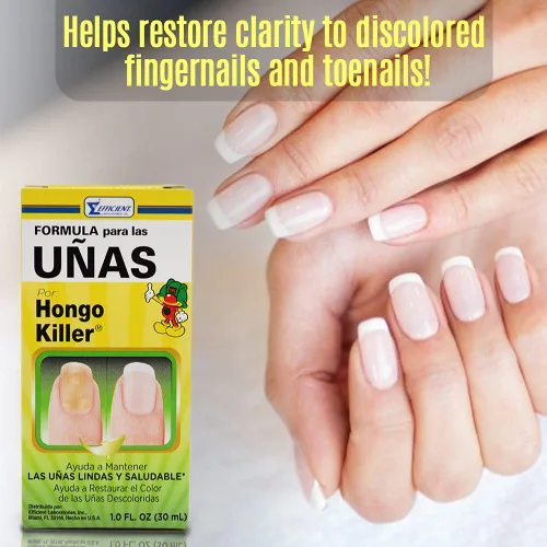 Vista 6 de Hongo Killer Fórmula de uñas de 1 oz (paquete de 6)