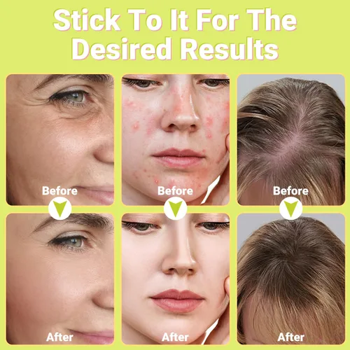 Vista 5 de Uaike - Varita facial de alta frecuencia, portátil, de mano, de alta frecuencia, con 4 tubos de vidrio naranja, dispositivo de varita facial