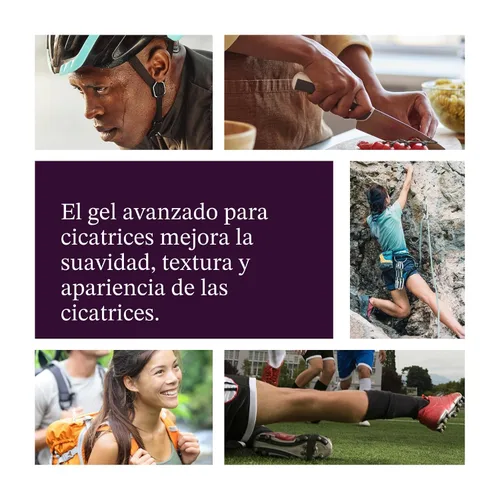 Vista 4 de Mederma Gel Avanzado para Cicatrices, Trata Cicatrices Nuevas y Antiguas, Reduce la Apariencia de Cicatrices de Acné, Costuras, Quemaduras y Más, 50