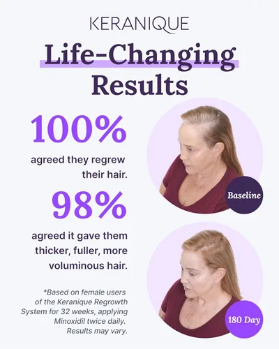 Vista 4 de Keranique Tratamiento para el crecimiento del cabello para mujeres, 2% de minoxidil para mujeres, crecimiento del cabello, fuerza y engrosamiento