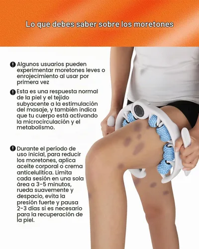 Vista 3 de Herramienta de masaje anticelulítico, removedor ergonómico de celulitis para piernas y brazos con asas desmontables, masajeador de drenaje linfático