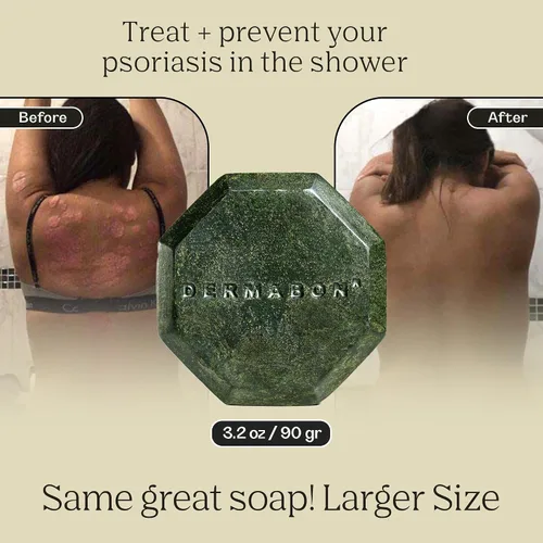 Vista 5 de Barra de jabón Dermabon para el control de la psoriasis, dermatitis y caspa con 2% de alquitrán de hulla como ingrediente activo - 1 paquete Jabón