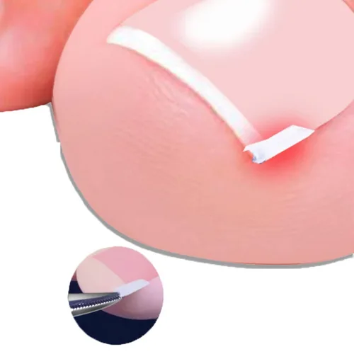 Vista 9 de Kit de 10 tiras correctoras de uñas encarnadas blancas, herramienta de pedicura gruesa, tira alisadora de uñas para hombres y mujeres, herramienta