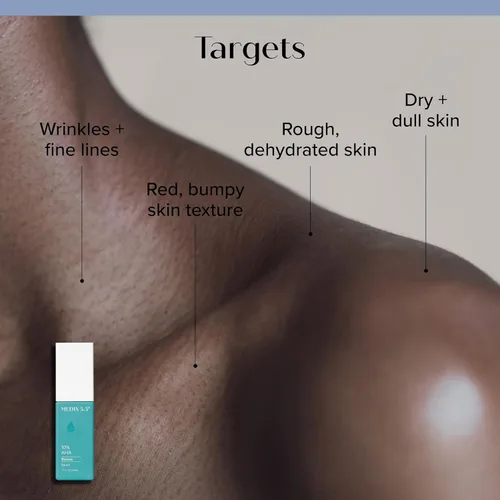 Vista 2 de MEDIX Gel exfoliante para el cuidado de la piel con ácido láctico 10% ácido glicólico y ácido láctico, suero exfoliante para cuerpo y cara AHA