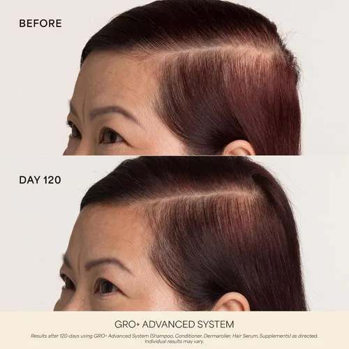Vista 3 de VEGAMOUR GRO+ Suplementos avanzados para el crecimiento y la densidad del cabello
