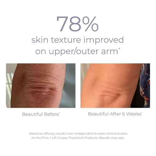 Vista 5 de DERMA E Crepey Skin Repair Treatment - Loción hidratante restauradora - Crema corporal para piel seca crepey - Crema reafirmante que mejora